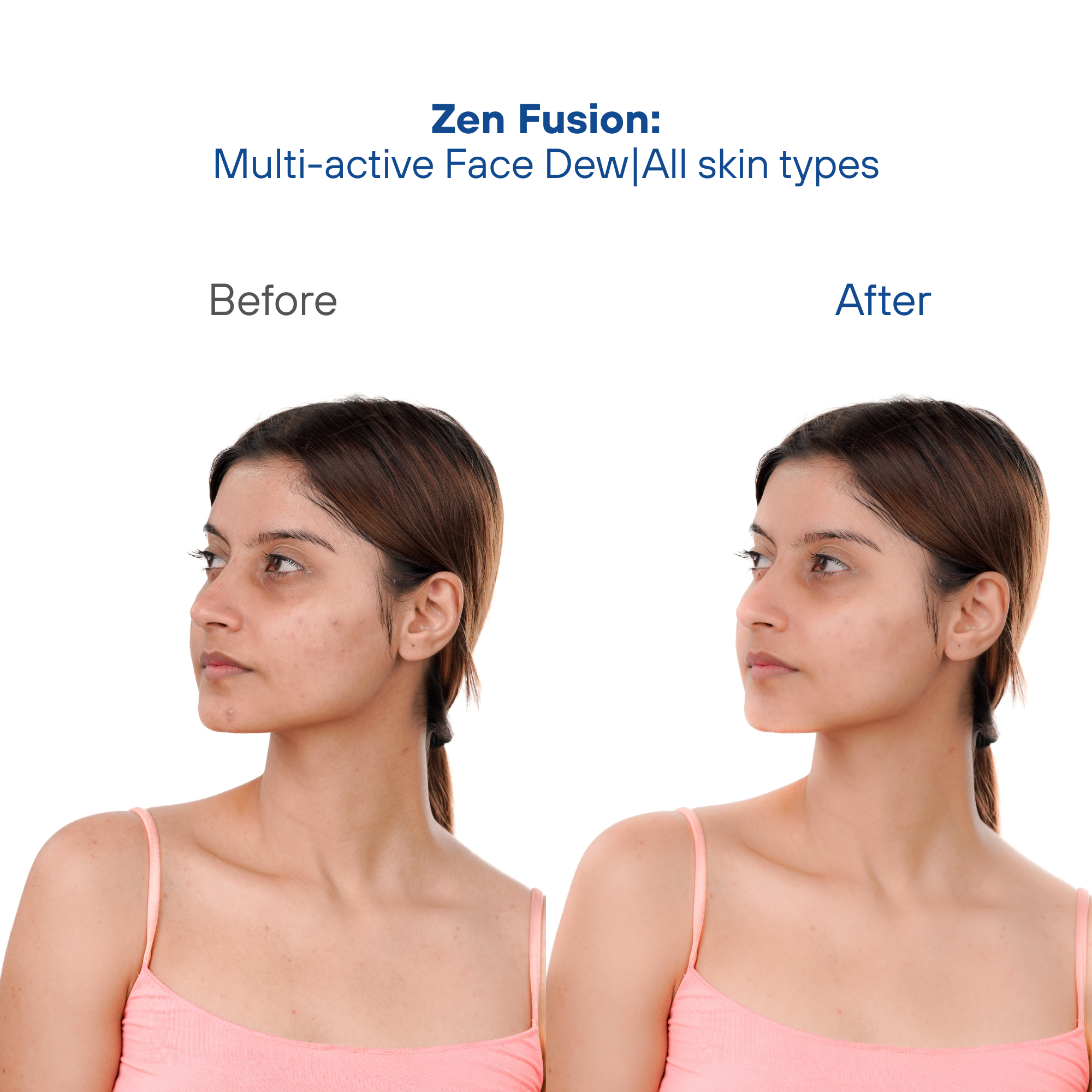 Zen Fusion: Multi-active Face Dew|All skin types